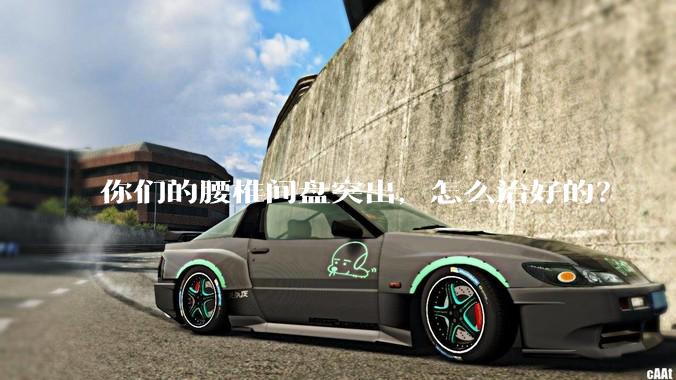 你们的腰椎间盘突出，怎么治好的？